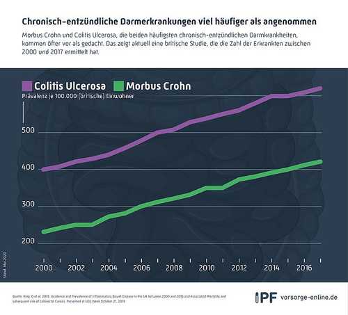 Chronisch-entzündliche Darmerkrankungen viel häufiger als angenommen (aktuelle britische Studie)