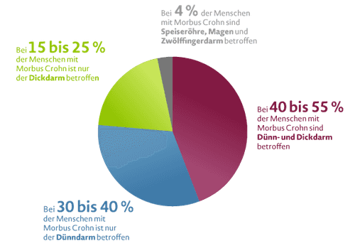 Morbus Crohn in Zahlen